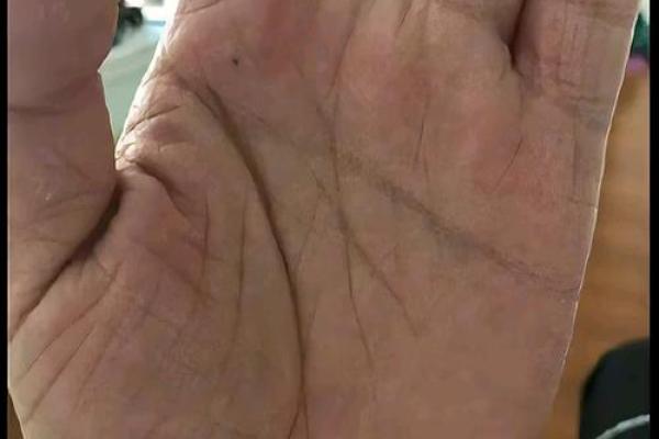 惊悚！大病手相曝光，揭秘健康危机！