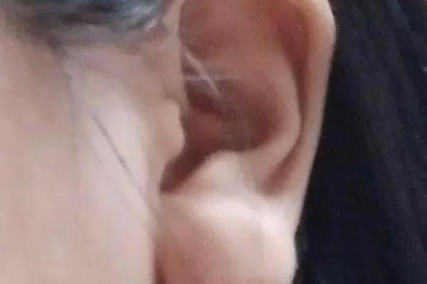 耳朵厚实显贵，面相透露年龄秘密
