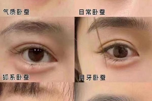 面相解析：卧蚕纹的运势与魅力解读