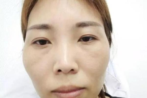 骨感美人的神秘面相：揭秘瘦小脸蛋的惊人魅力！