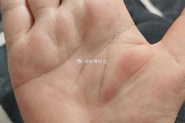 手相揭秘：堕胎留下的神秘印记