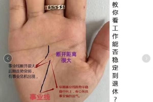手相看肺，一招教你掌握健康风向标！