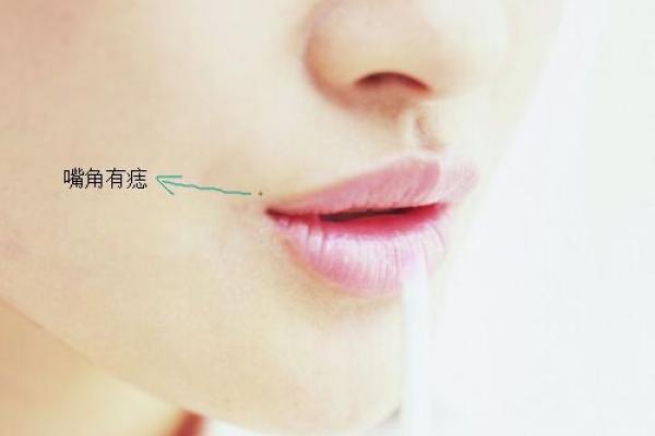 嘴唇上的吉痣：嘴里长痣的人，福气满满！