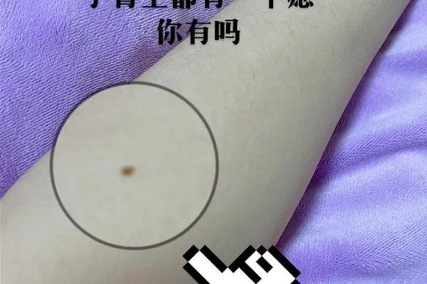 独家！手臂相痣图解大全，一眼看穿命运密码！