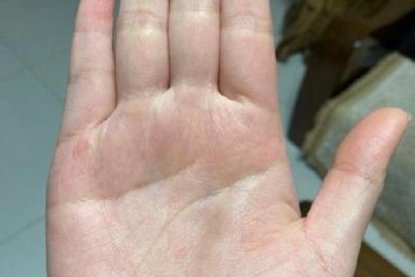 手中藏着黄金：揭秘元宝线手相的富贵运势