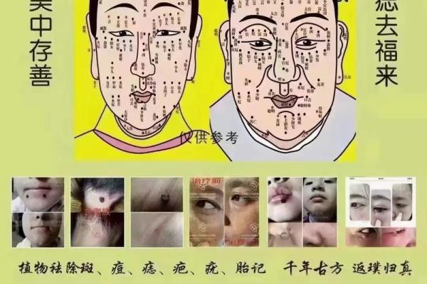 脸上痣的相学解读：是真的吗？揭秘神秘面纱