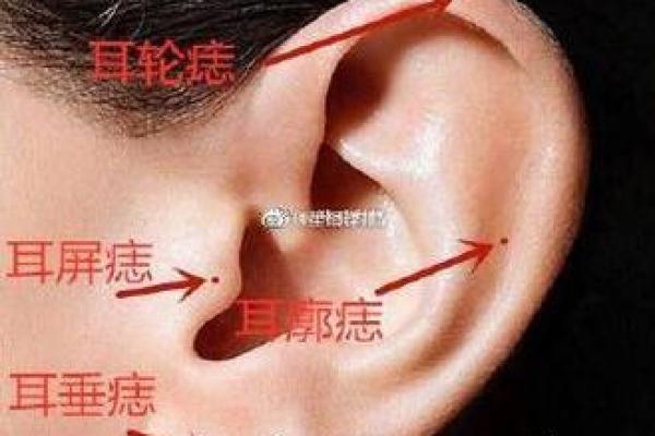 魅力四射！女性财运痣相的神奇魅力！
