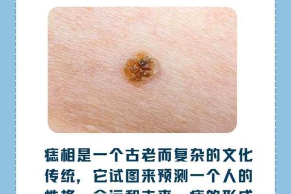 神秘痣相揭示未来命运！