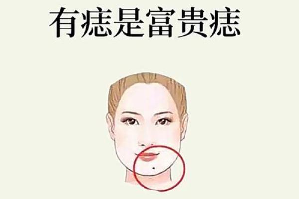 耳后痣相运势榜：女人运势的神秘指南